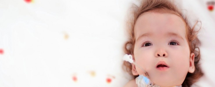 Infant with Down syndrome lying on a white blanket with red and yellow dots. Infant has a feeding tube.