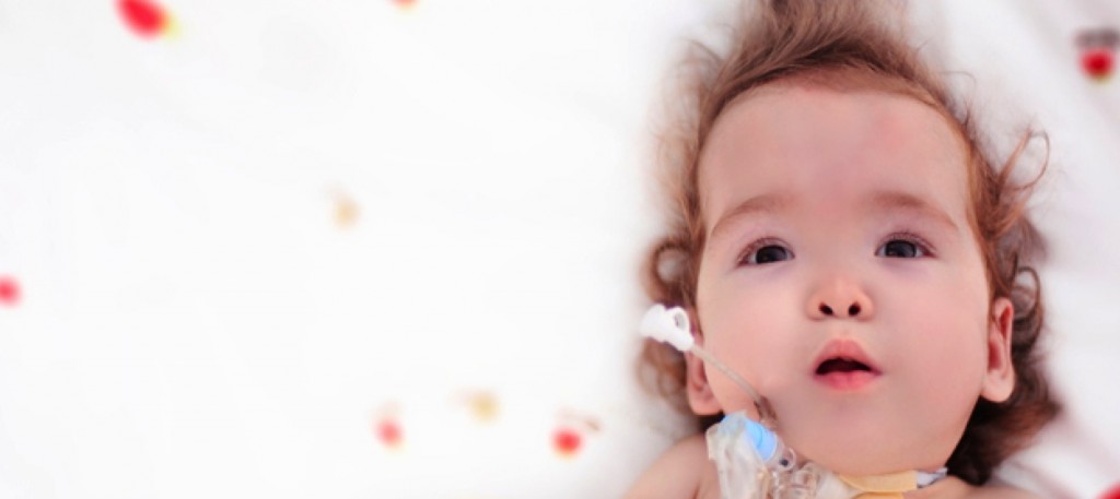 Infant with Down syndrome lying on a white blanket with red and yellow dots. Infant has a feeding tube.