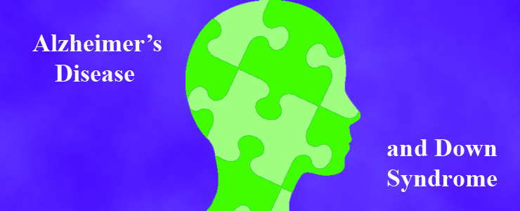 Alzheimer's Disease and Down syndrome graphic of a human head composed of puzzle pieces
