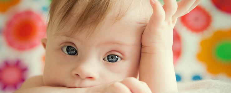 little baby girl with Down Syndrome on soft cream colored blanket with multicolored background